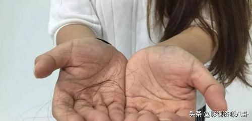 *处私**的毛发为何是卷的？这些相关的秘密，了解一下有好处