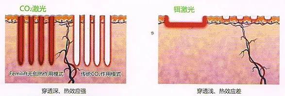 这项抗衰老技术,让美丽由内而外!女性朋友值得体验……