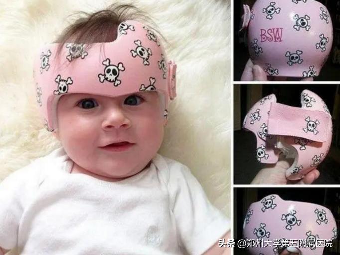 郑州大学五附院康复科怎么样,郑州大学五附院儿科