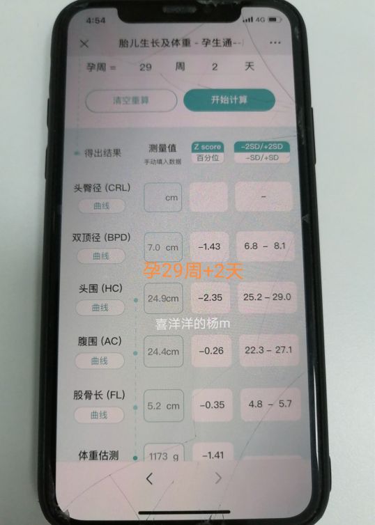 怀孕29周加6天胎儿偏小一周正常吗,孕37周宝宝4斤多正常吗