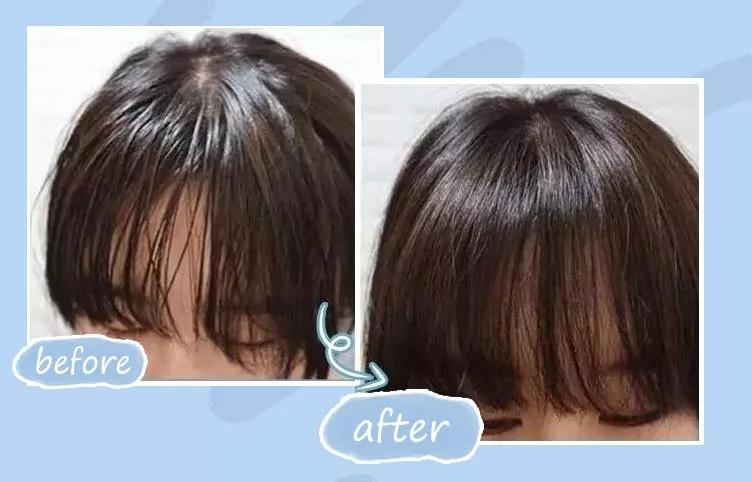 天天散着头发容易脱发吗,头发油了特别容易脱发