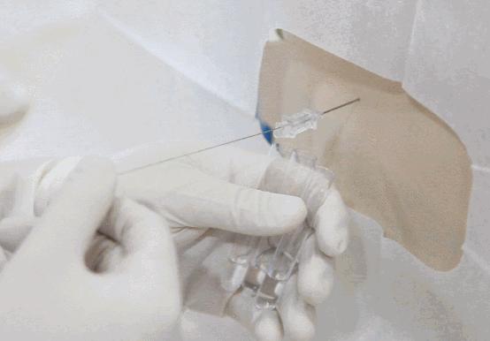 脑脊液检查结果都没事,脑脊液常规数值100