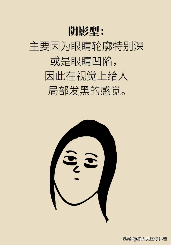 有眼袋怎么办五种去眼袋秘方,眼袋重最简单的去眼袋的方法