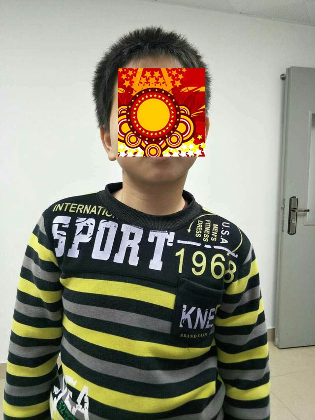 医生说孩子脖子歪了要做康复,三个月宝宝脖子老是歪向一边