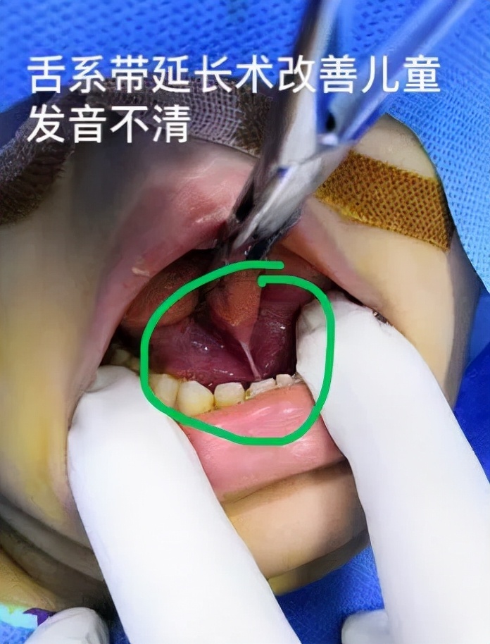 孕妇有牙病可以治吗,备孕牙齿上药需要注意啥