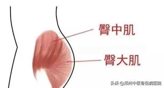 走路摇晃的元凶——臀中肌,看推拿师如何精准治疗?