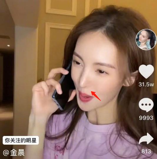 金晨的鼻子太尖惹争议,金晨回答鼻子问题