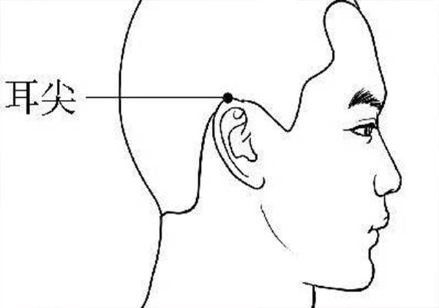 小姐姐脸上长了青春痘,小姐姐担心长斑长痘