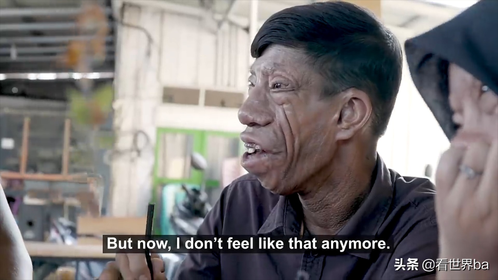 印尼家族怪脸,印尼怪病