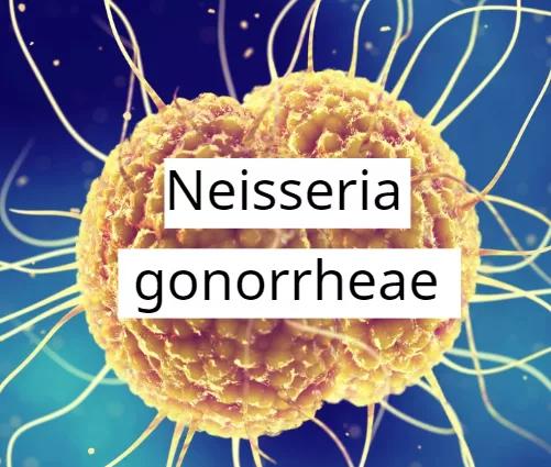 窥一斑而识全貌,窥一斑而知全貌出自哪里