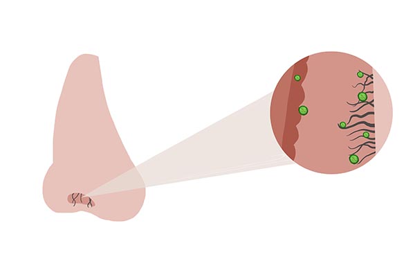 鼻毛窜出来后应该是剪掉还是拔掉,鼻毛长出来了要不要剪掉