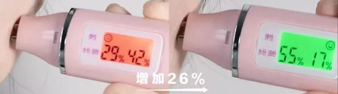 医美收毛孔价格表,医美收毛孔效果