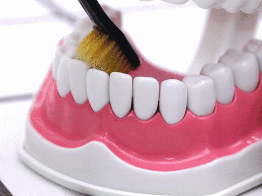 每年去洗一次牙会蛀牙吗,洗完牙医生建议深度清洗有必要吗