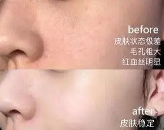 49岁袁咏仪用什么护肤品好用,袁咏仪推介护肤品