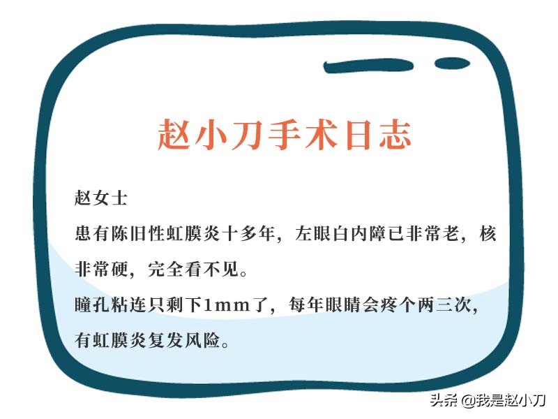 虹膜炎瞳孔已经粘连了怎么办,虹膜炎瞳孔粘连打针需要几次