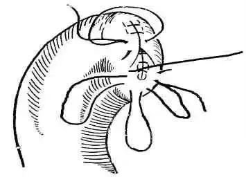 外科缝合方法笔记,兽医外科手术中最常用的缝合方法