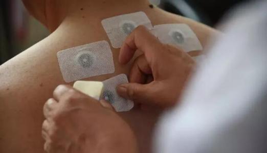 冬病夏治三伏贴的正确贴法,冬病夏治的三伏贴到底有没有效果