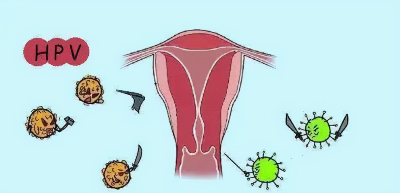 患有妇科炎症怎么办,患有妇科疾病的应该注意什么