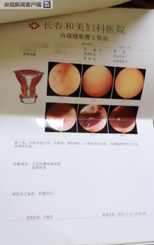 长春和美妇科医院处理的结果,长春和美妇科医院广告视频