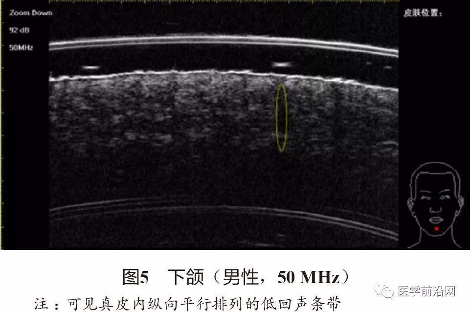 常见皮肤病高频皮肤超声诊断专家共识全文发布