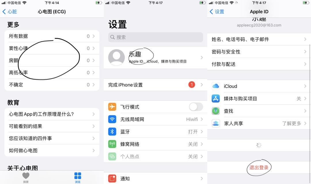 applewatch测ecg心电图,applewatch如何激活ecg
