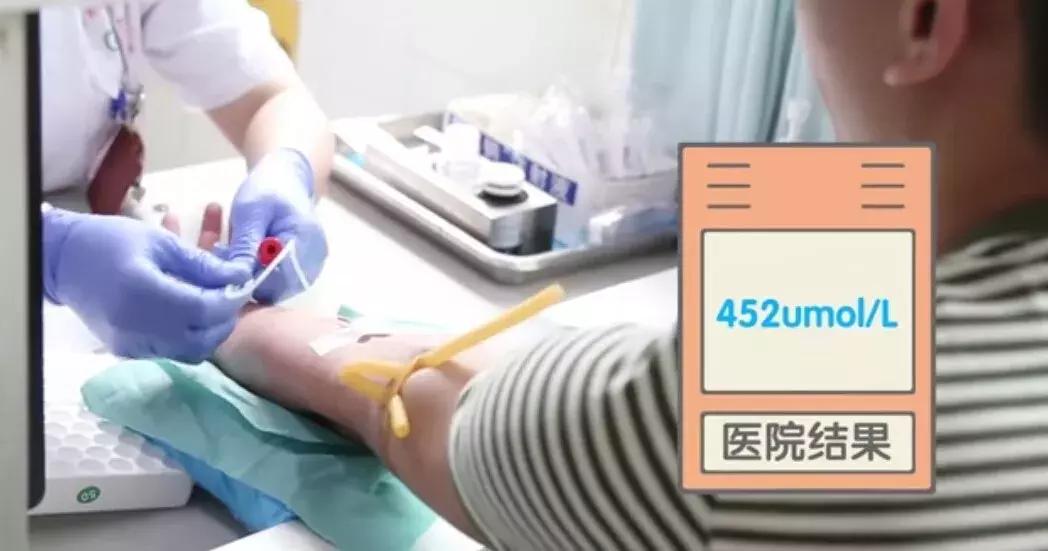 痛风检测仪器有用吗,痛风患者如何选购尿酸测试仪器