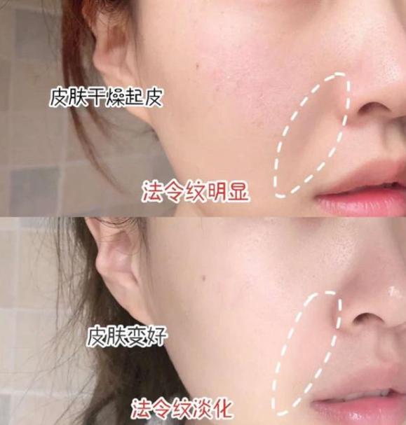 被称为“眼部橡皮擦”，消除除皱纹、淡化黑眼圈，熬夜*党**的福音