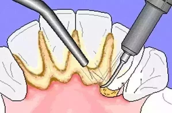 瞎搞，吸氧一天每天45小时计量收费！告他！