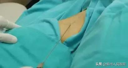 对味道敏感的人怎么办,对味道特别敏感的人真的很崩溃