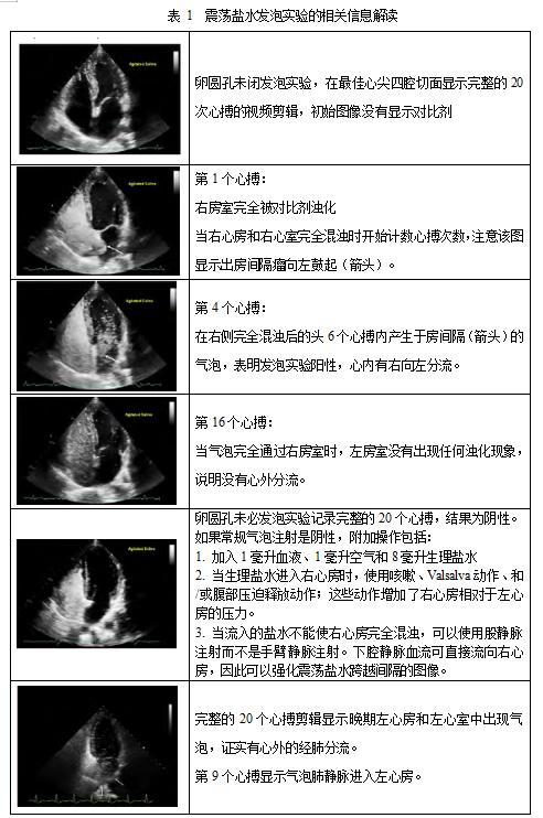 成人经胸超声心动图指南震荡盐水造影