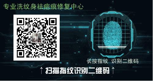 洗纹身咨询李医生,昆明李医生洗纹身是真的吗