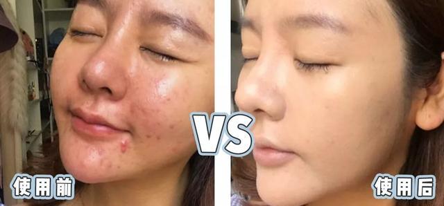 张韶涵海蓝之谜完整版视频,张韶涵小红书海蓝之谜