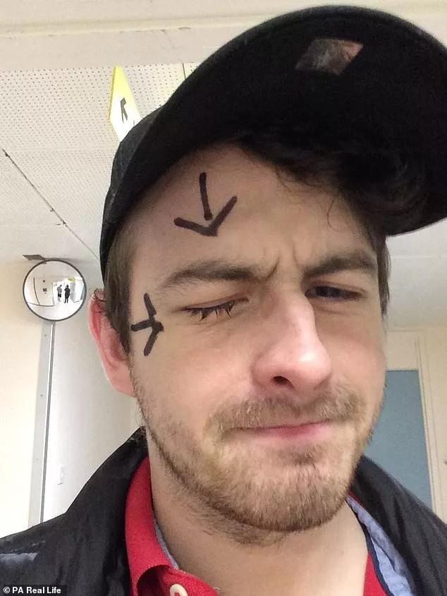 长期戴隐形眼镜眼睛里长满了溃疡,戴隐形眼镜长寄生虫前有哪些症状