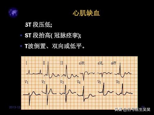 无痛胃镜检查后的注意事项有哪些,无痛胃镜肠镜陪同家属要注意什么