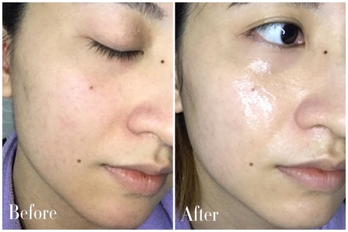 一张面膜让你皮肤好到爆,一片面膜能试出效果吗