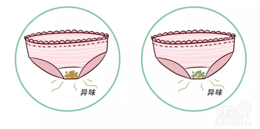 秋冬季宝宝红屁屁怎么快速消除,2岁多宝宝红屁屁怎么护理好得快