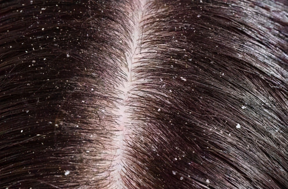 如何清理皮肤上口香糖,衣服粘口香糖怎么处理干净