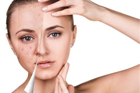 鼻头长痘痘什么原因怎么解决,鼻头长痘的原因教你轻松解决问题