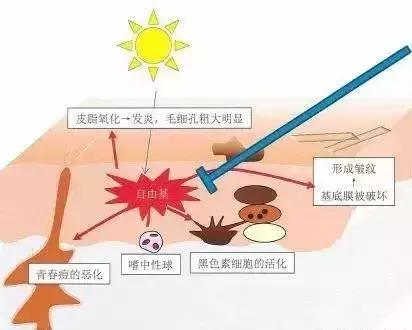 钻石抗衰,钻石抗衰老