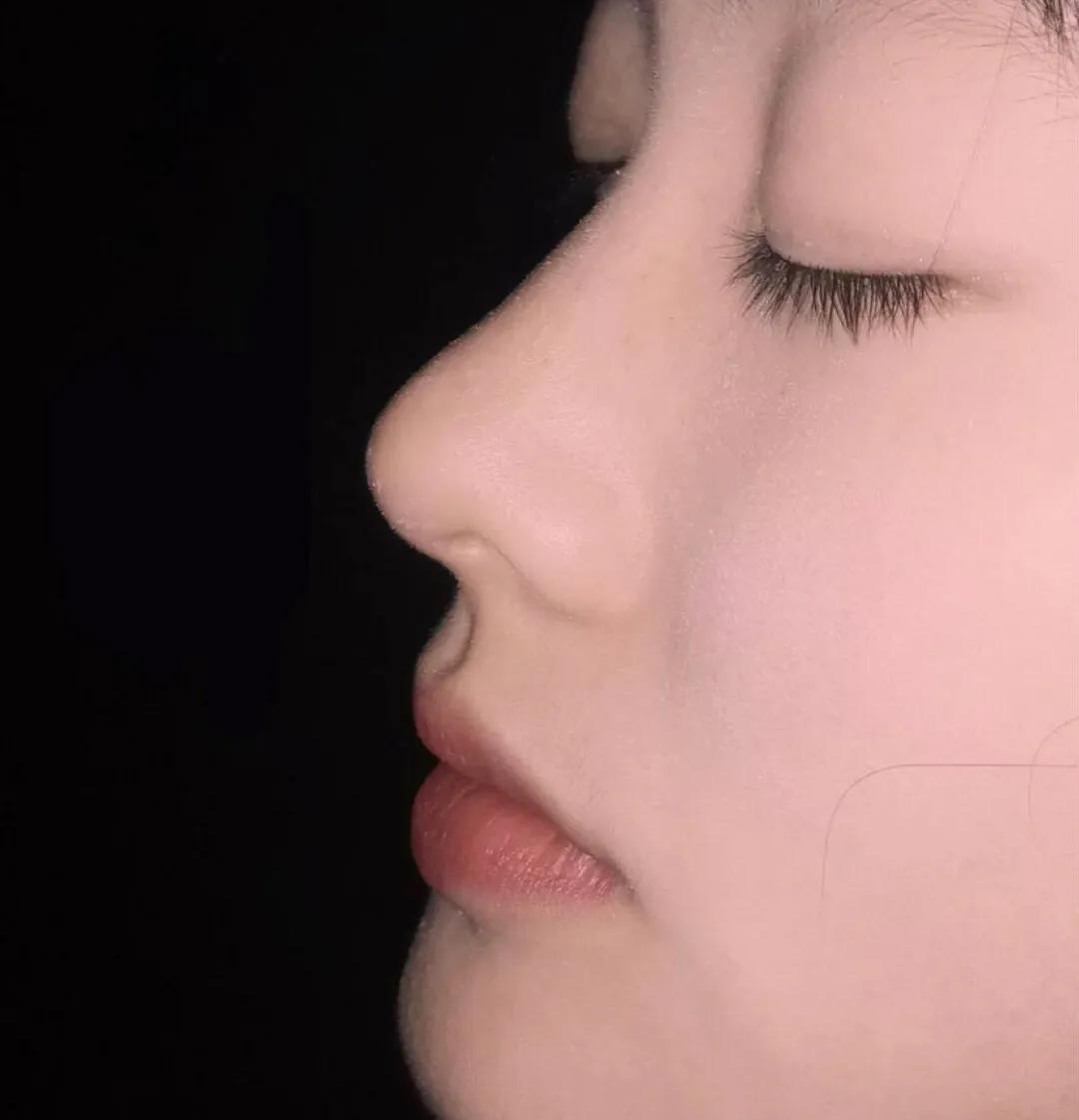 成年人如何自然美鼻,自然美鼻注意事项及禁忌