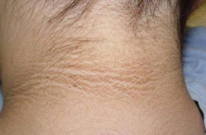 孕妇眼前黑了一下对胎儿有影响吗,孕妇怀孕后为什么变黑