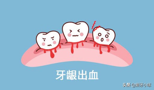 刷牙老是出血用什么牙膏比较好,孕期刷牙出血什么原因