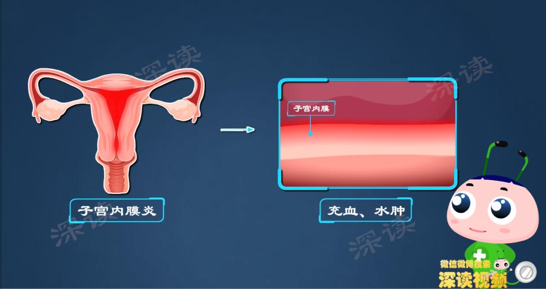 没有白带下腹痛会是附件炎吗,小腹胀痛有白带有妇科炎症吗