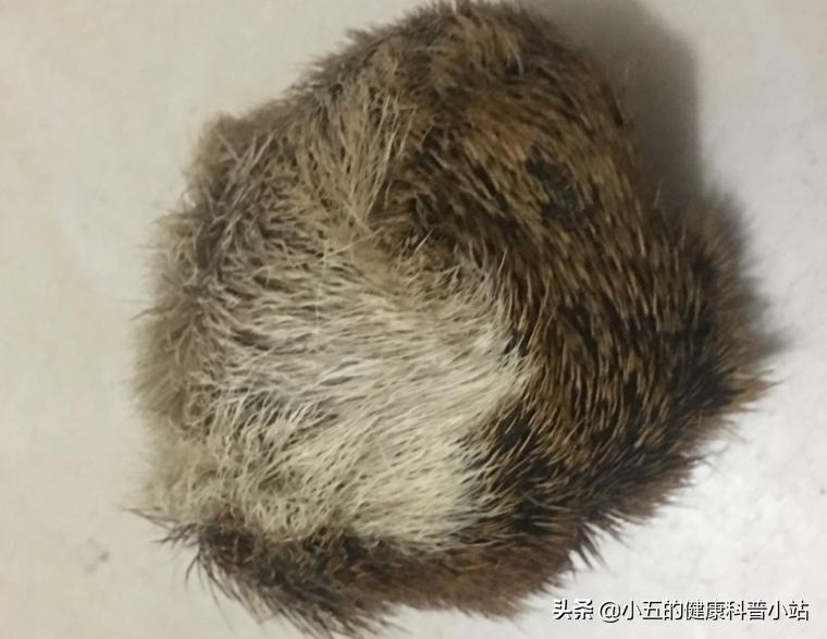 调理冠心病的中药方,调理冠心病中医讲座视频