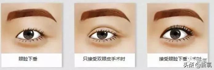 自带情绪的眼睛,最近流行三白眼美人