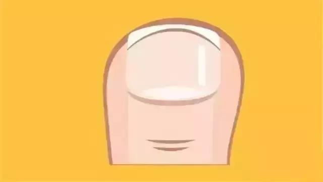 脚趾甲长进肉里剪不出来疼,彻底治愈脚趾甲往肉里长的方法