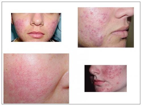 皮肤科医生经典小故事,皮肤科病例故事