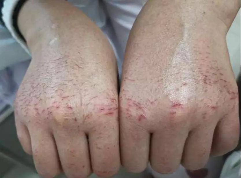 抗疫感人事件感悟作文素材,关于抗疫的作文素材大学