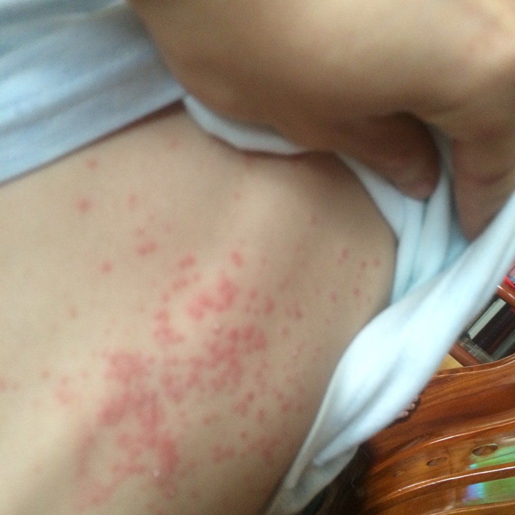 宝宝用湿巾擦屁股的正确方法,为什么用湿巾给宝宝擦屁股会红