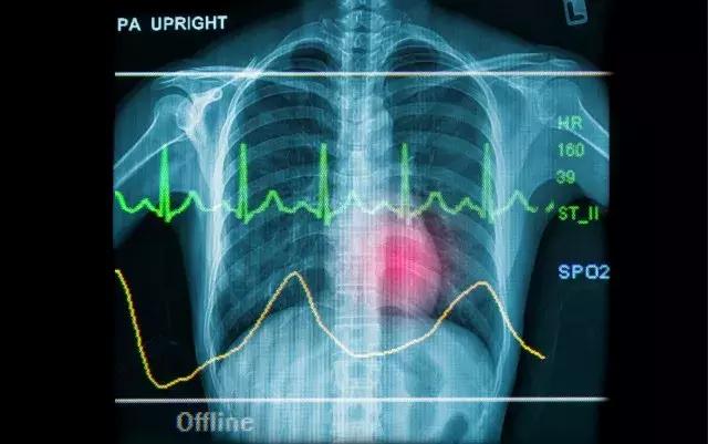 小心脏砰砰跳怎么回事,小心脏乱跳怎么办